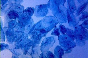 Methylene Blue Nuclear 100ml